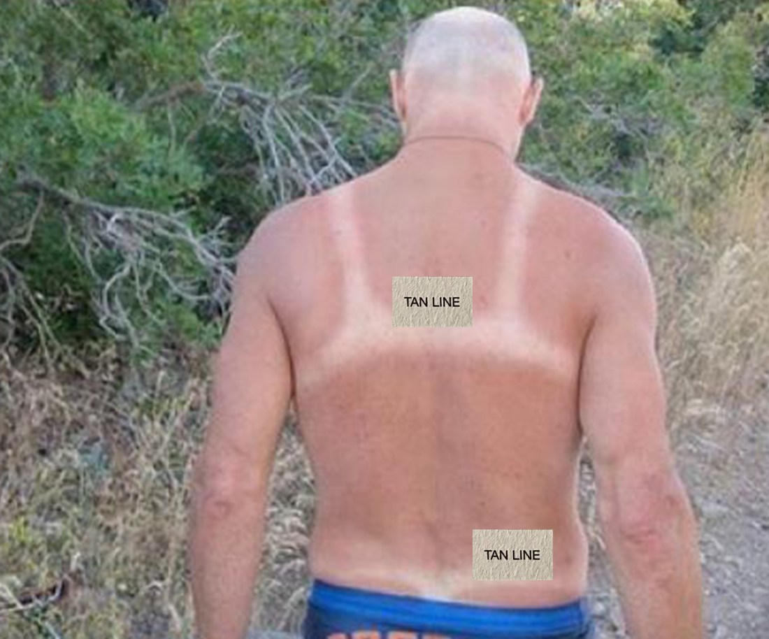 Tan line
